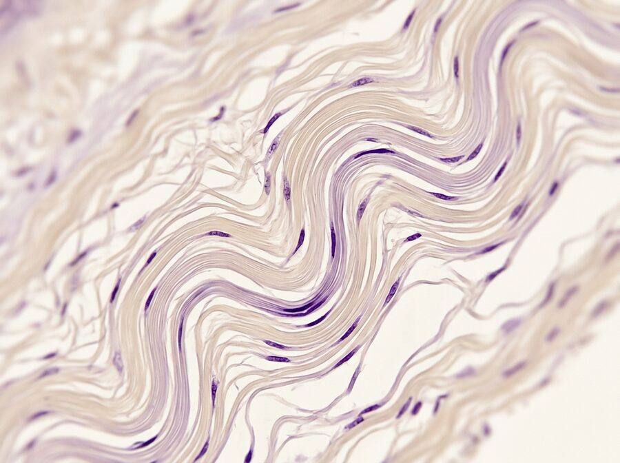 Implantes para Tecidos Moles
